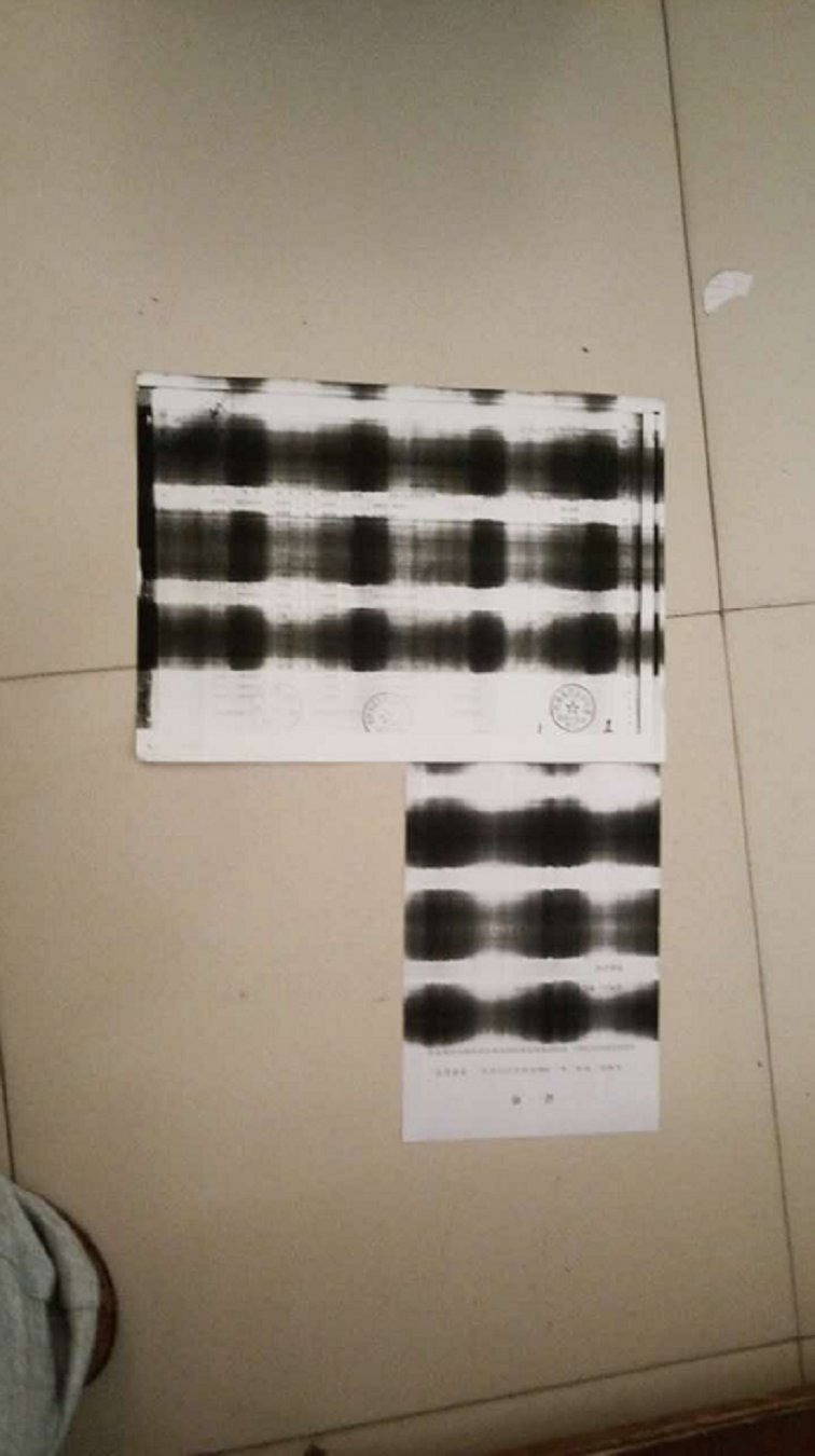images/2/2017/06/H3Mzeggg3bMg3m7SFsS3ug5ggpUsmg.png